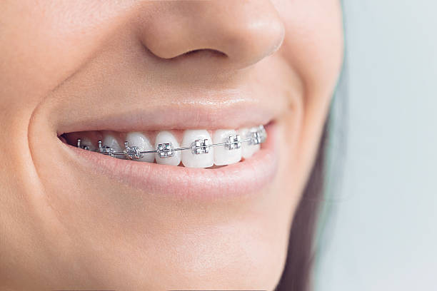 Best Teeth Whitening  in Rosharon, TX